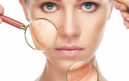 Znate li koji tip kože imate?